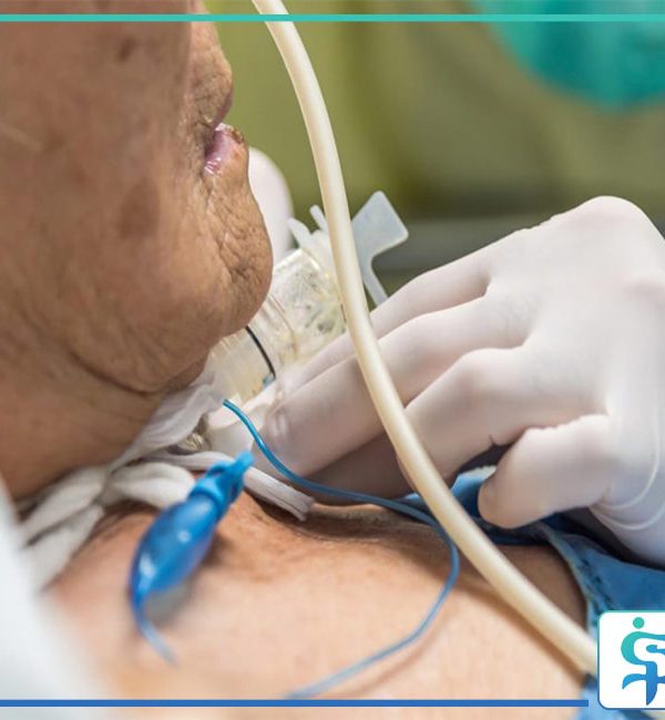 مراقبت از بیمار تراکئوستومی در منزل