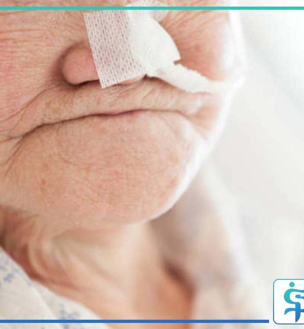 نگهداری از سالمند دارای لوله تغذیه
