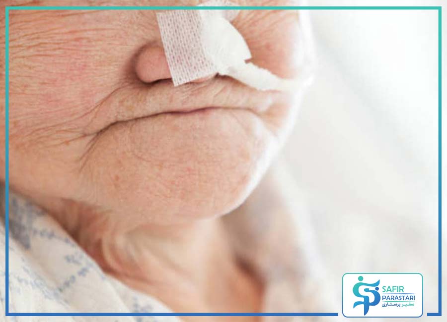 نگهداری از سالمند دارای لوله تغذیه