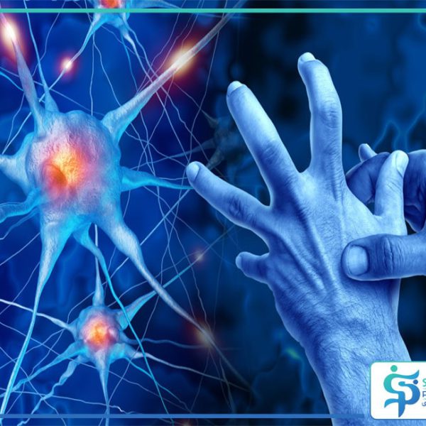 پیشگیری از پارکینسون