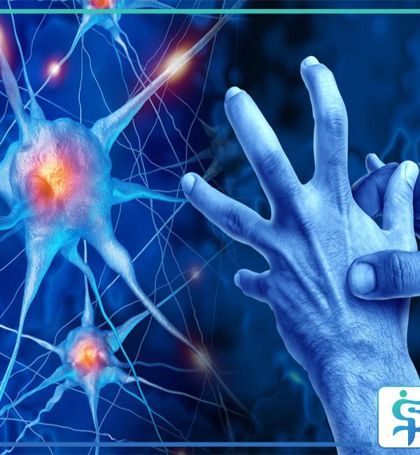 پیشگیری از پارکینسون